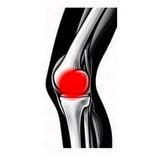 Schéma de l'articulation du genou