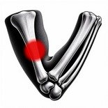 Schéma de l'os du bras